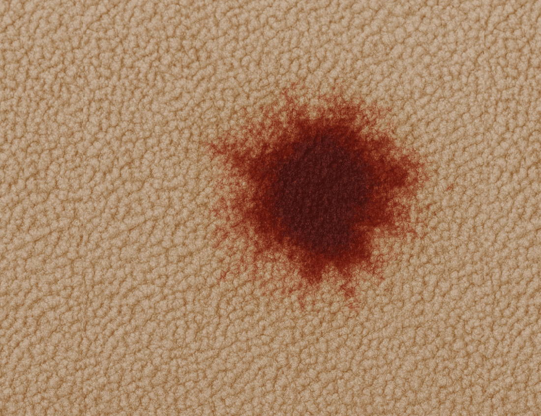 How To Get Blood Out Of Carpet: Step-by-Step Guide