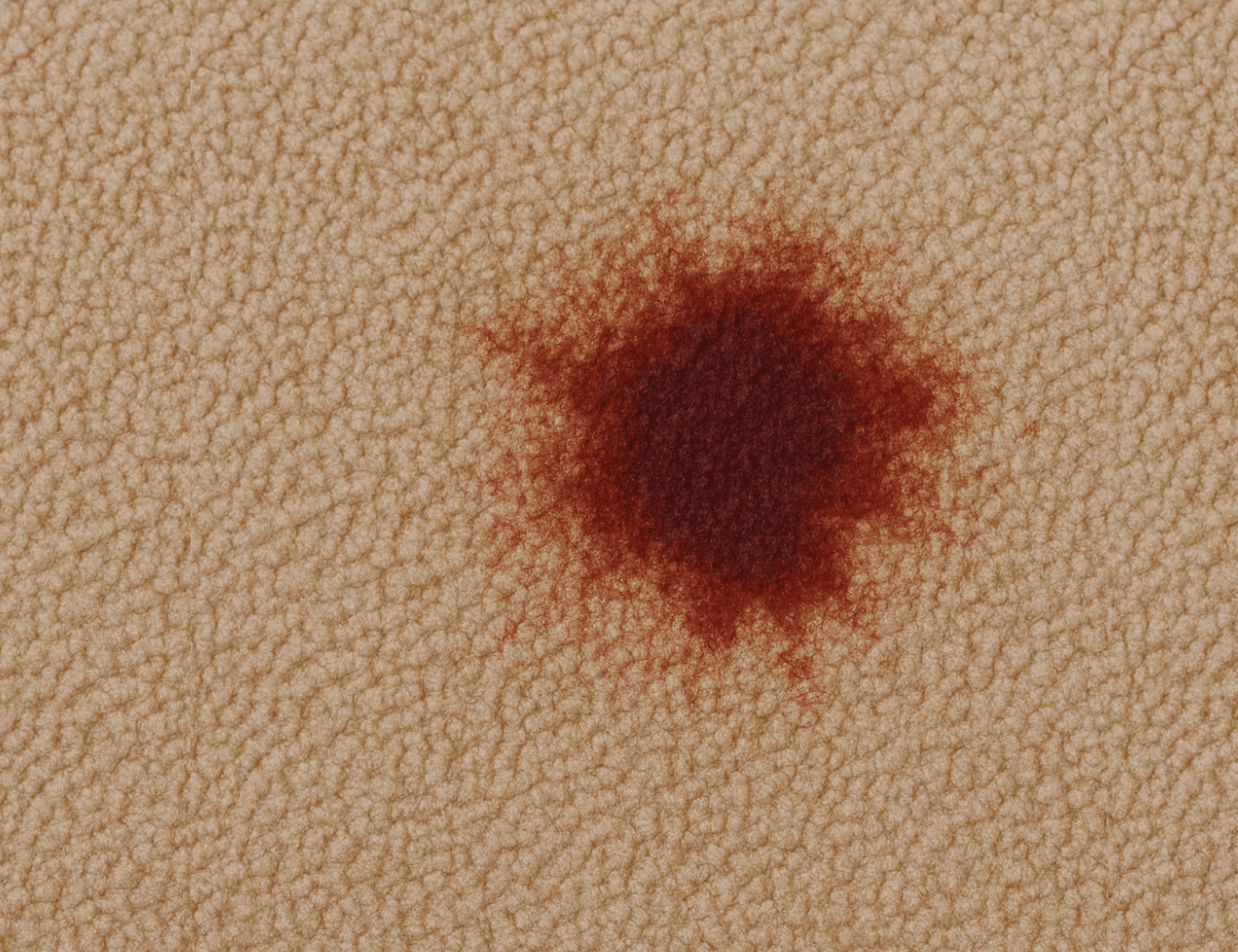 How To Get Blood Out Of Carpet: Step-by-Step Guide